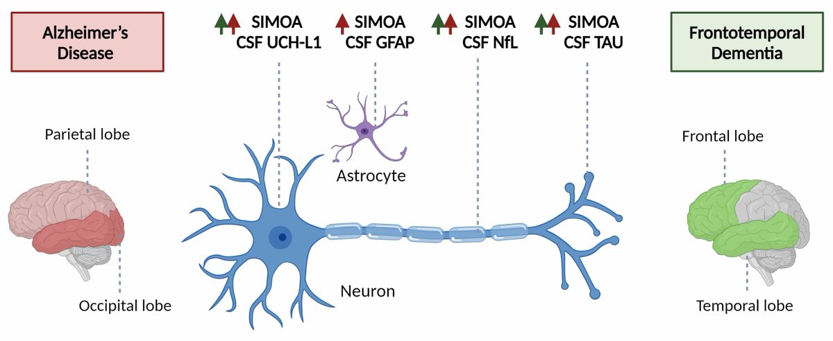 Biomed_MDPI's tweet photo. 🖼 Graphical Abstract | Explore the key findings through graphics  
📌 SIMOA Diagnostics on Alzheimer’s Disease and Frontotemporal Dementia
🔗 https://t.co/oV3uMWYBAV
#VisualResearch https://t.co/stYl0mOkmn