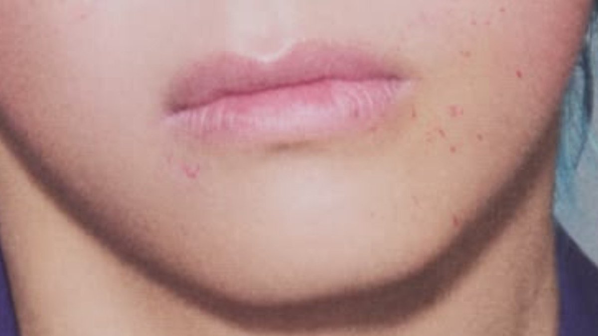 neilperrysme's tweet photo. taehyung's lips https://t.co/b6OgI26hgT