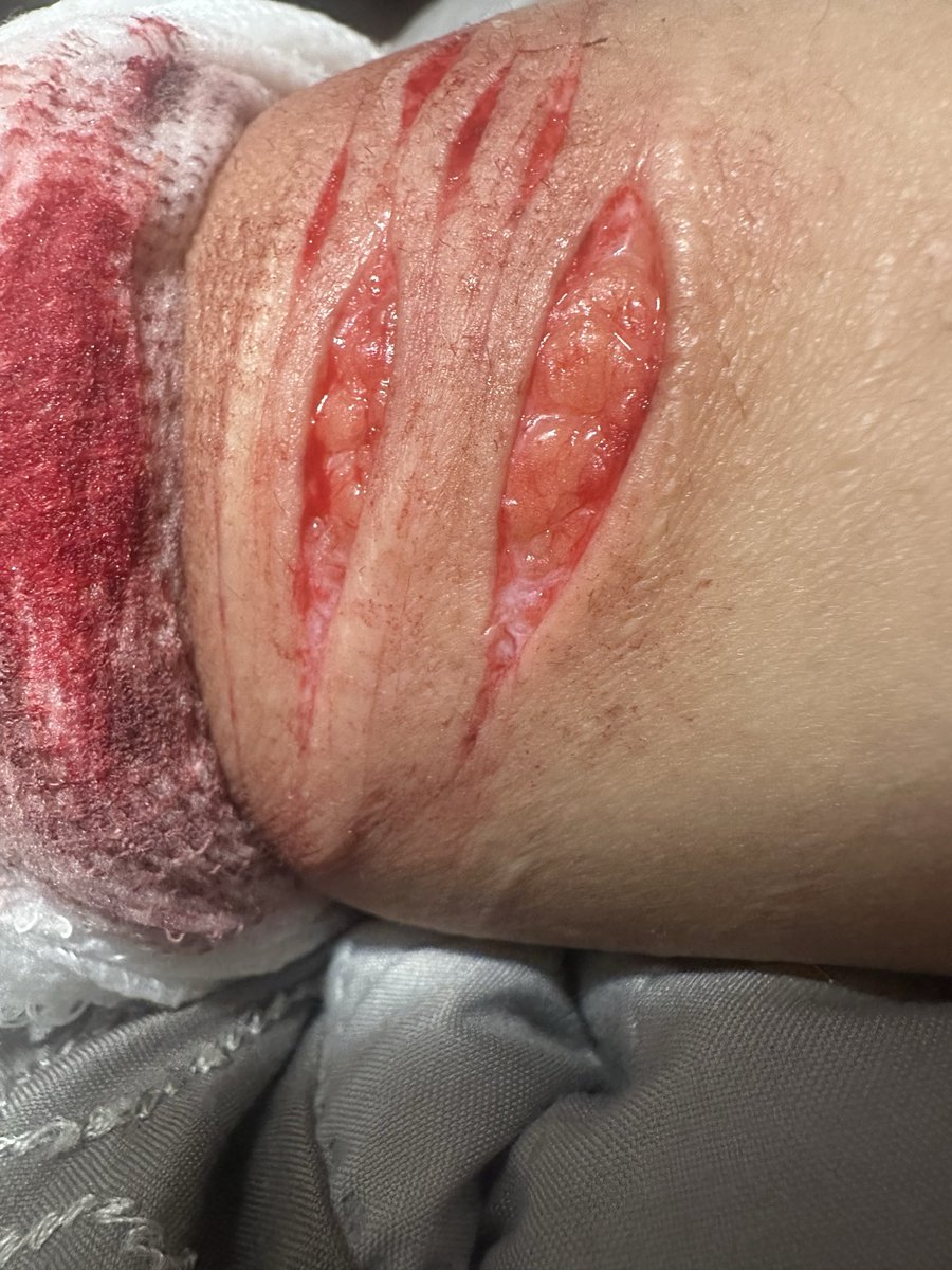 toeticklr689's tweet photo. wow oh my gosh rate from 1-10 how awesome my FAKE!!!! SFX!!!! HORROR MAKEUP!!! looks😋🧁🍭 https://t.co/lRUyuoH0PN