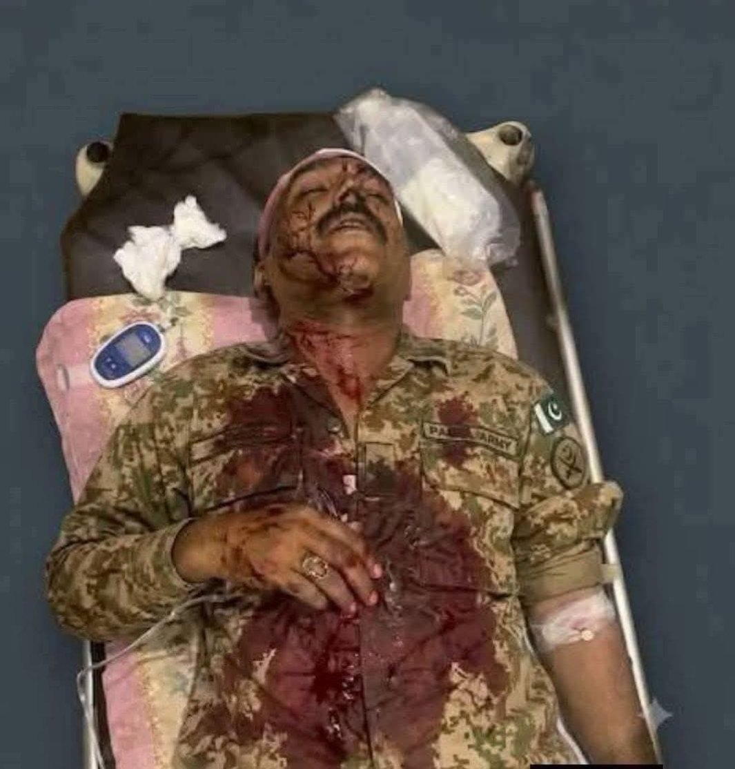 BaBabaloch32's tweet photo. فضلو کو پکڑ کر جیل میں بند کر دینا چاہیے اس نے ہمارے شہیدوں توہین کی ہے چاہے وہ کسی بھی پارٹی سے کیوں نہ ہو جو ہمارے شہیدوں ہمارے جوانوں ہماری فوج کے خلاف بات کرے گا اسے سیاست دان ہمیں نہیں چاہیے فوج ہے تو ہم ہیں یہ ملک ہے 
#فضلو_ٹولہ_استعفیٰ_دو https://t.co/uYyChm04Lc