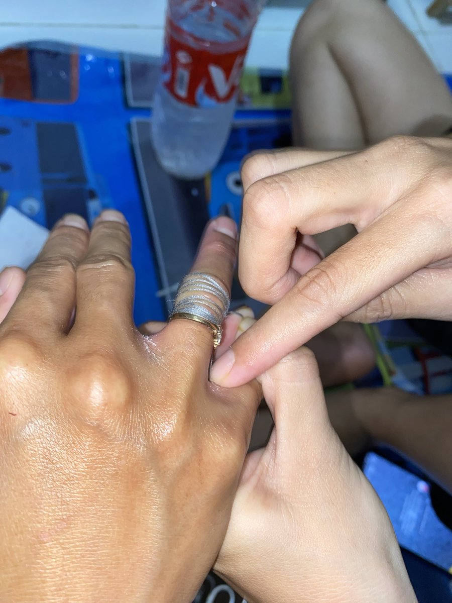 zf_ahra's tweet photo. Mau share pengalaman aku yang minta tolong ke DAMKAR hari ini🧑🏻‍🚒😆

Jadi cincin aku sempit, gabisa lepas udah pake sabun, lotion, bahkan nyoba pake minyak😭 sempet nyoba ikutin tutor pake benang gitu sama tali tapi tetep gabisa😭 https://t.co/19AlDIbqx7