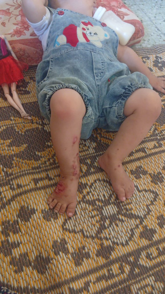 Voicefrom_gaza's tweet photo. Please, my daughter Bahaa needs your support and prayers. Please pray for her speedy recovery. https://t.co/6xVdYJLNmO💔🥺🙏 https://t.co/c93Rkxm080