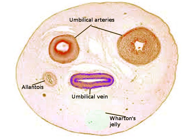 Chiragrx07's tweet photo. @drkeithsiau Umbilical cord. https://t.co/jVi5Vwyhkj