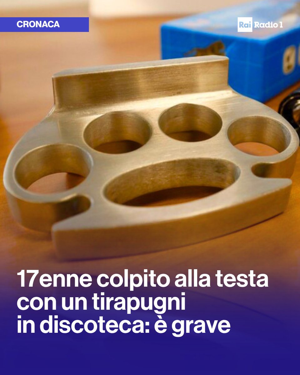 Radio1Rai's tweet photo. 🔵Violenta #aggressione all'uscita di una nota discoteca di #Gallipoli dopo una lite cominciata nel locale: un #17enne in vacanza è stato colpito alla testa e all'addome, probabilmente con un tirapugni. Grave, è ricoverato a Lecce. https://t.co/LgDtZFyMal