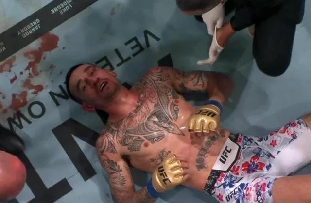 Conor McGregor confirms torn ACL and meniscus after 69‑second UFC 329 loss — related image 3 Conor McGregor confirms torn ACL and meniscus after 69‑second UFC 329 loss — related image 3