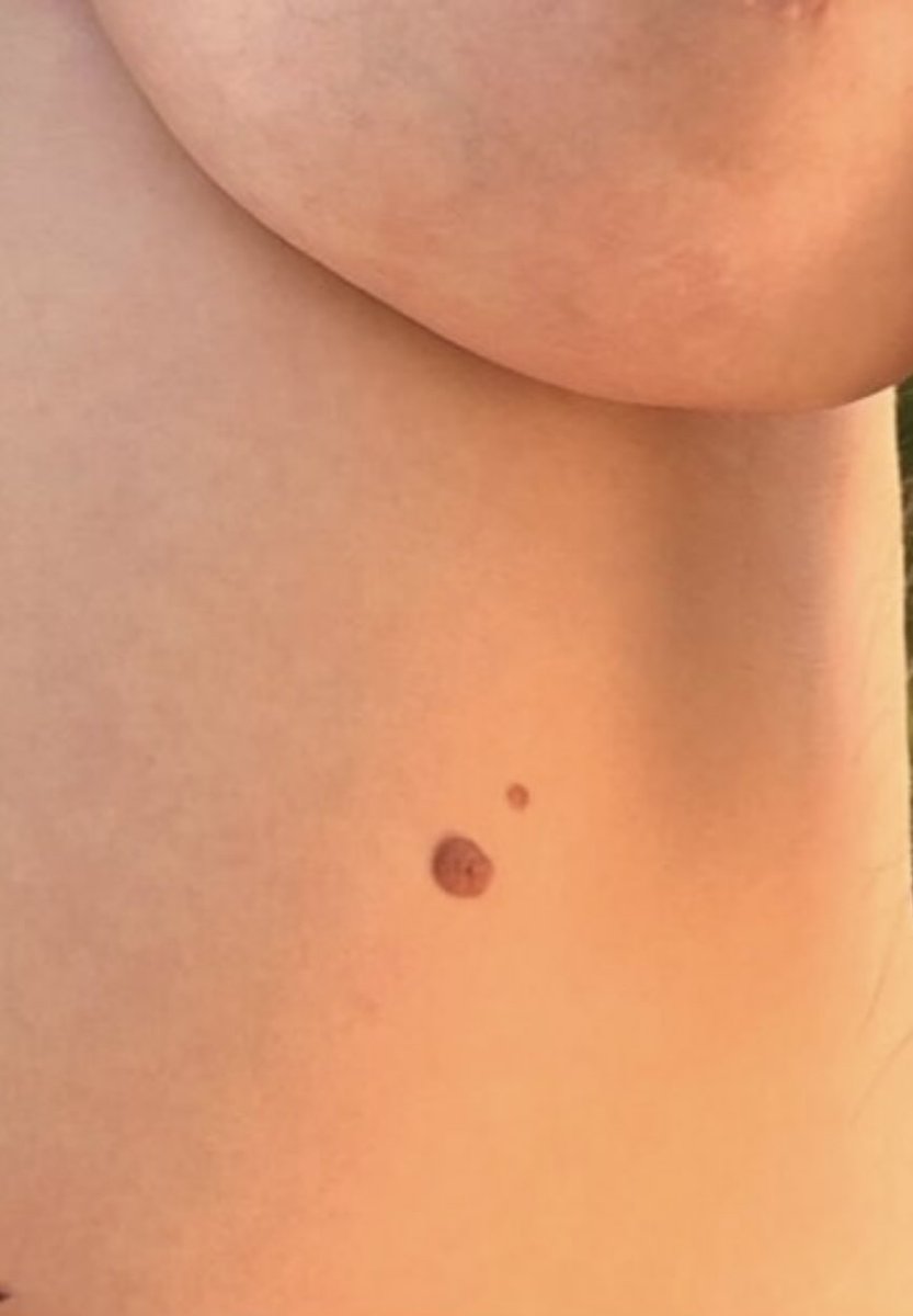 alirobbo76's tweet photo. @LanaWolfXXX Is that the earth and the moon tattoo? https://t.co/Gqm3f9ieW1