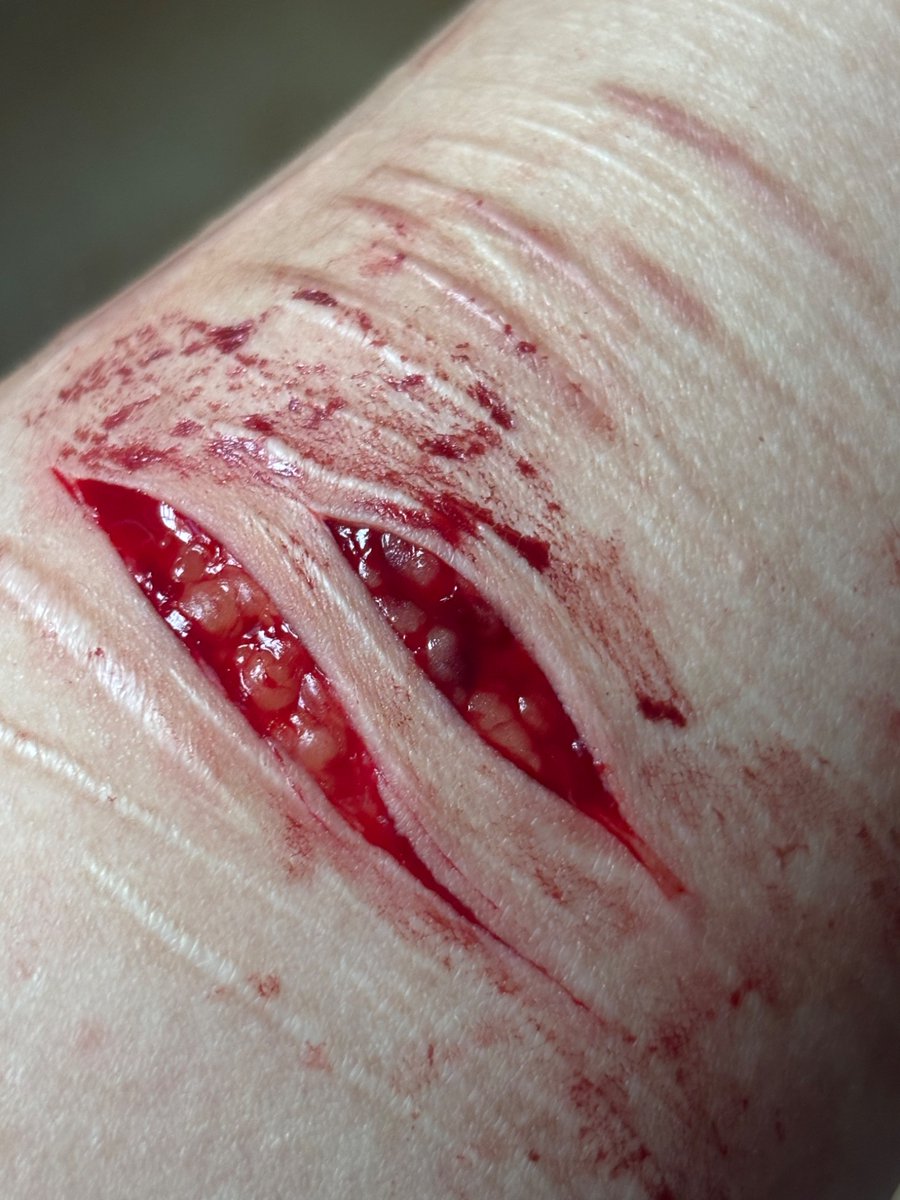 withu_4ever_'s tweet photo. all fake sfx makeup sfx artist #shtwt #988twt  #cutspo https://t.co/p2mE5Du1lv