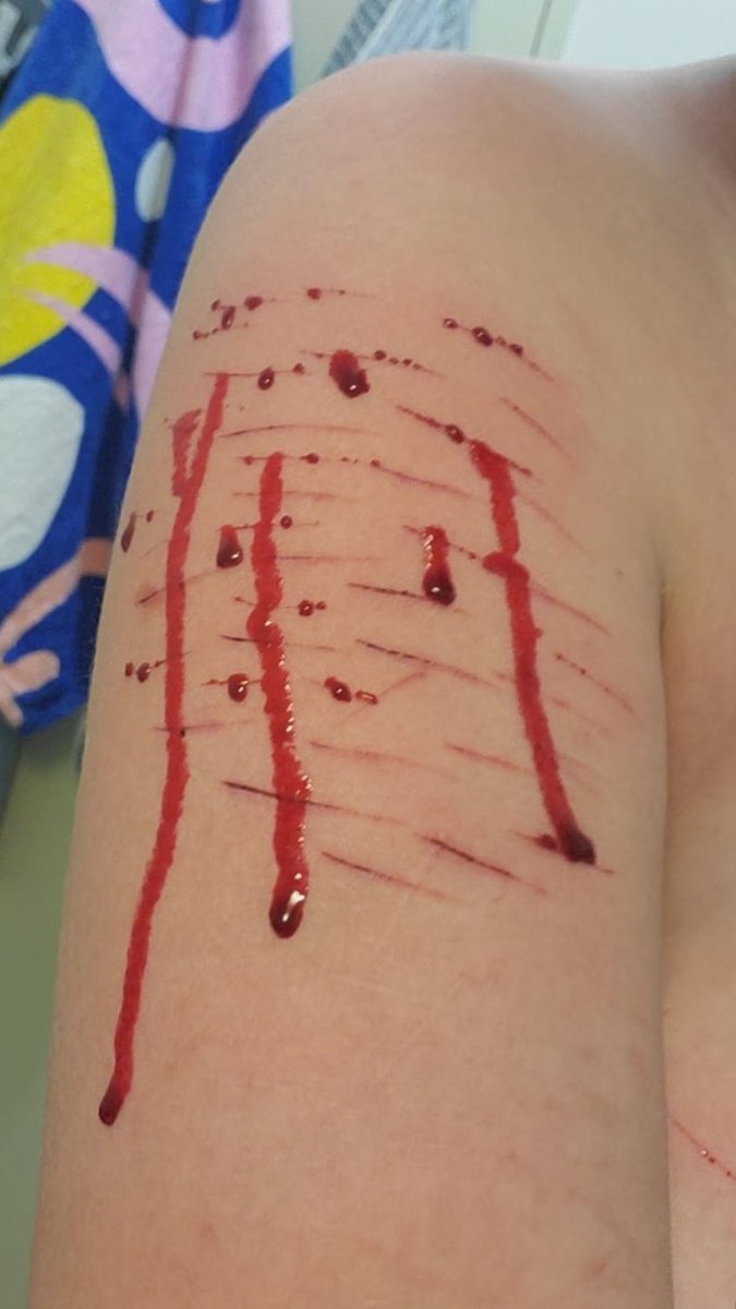 Naos0a's tweet photo. I just can't wait anymore, when I'll find my shirt with long sleeves, I'm gonna cut sm all over my arms.

ALL FAKE SFX MAKEUP AI GENERATED NOT REAL AND NOT PROMOTING SELF HARM

I cut a bit before my shower https://t.co/lbt97Uzl4M