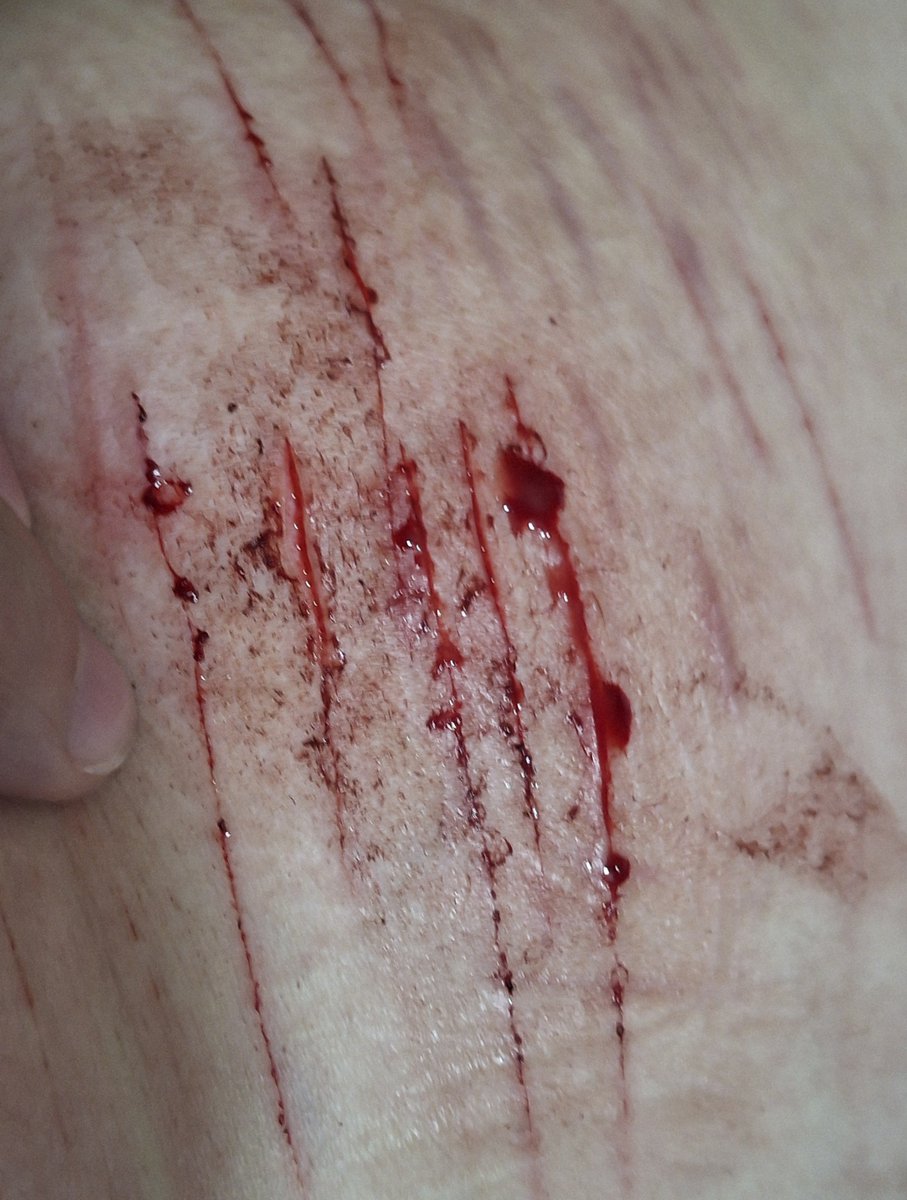 yr_yop's tweet photo. Soyy una fracasada hasta para rajarme💔

-fakee! https://t.co/XfwMFcrIHa