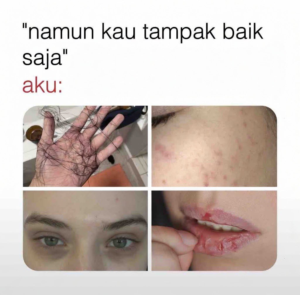 naivarian's tweet photo. https://t.co/LfTUY9EkAN