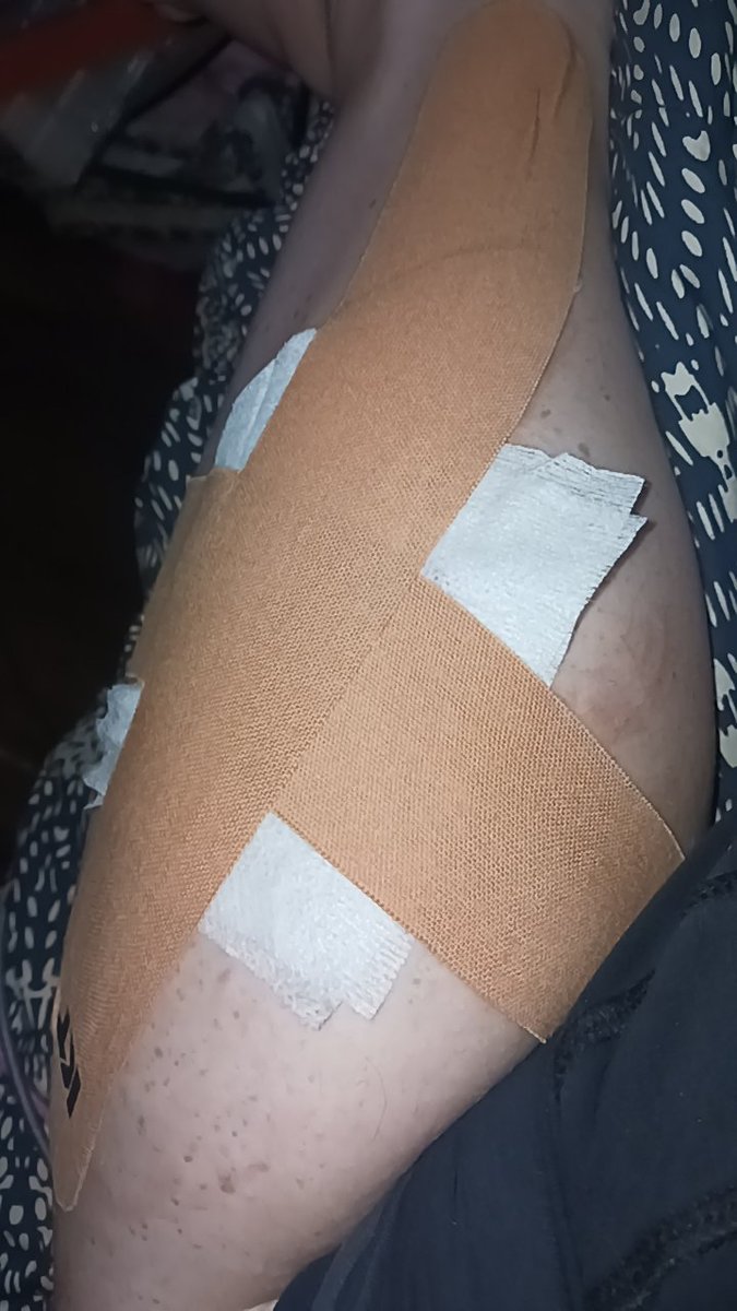 Haileylkib's tweet photo. And aftercare cause these cannot get infected>< and need to heal by hopefully Saturday!! https://t.co/DWdvPYYawl