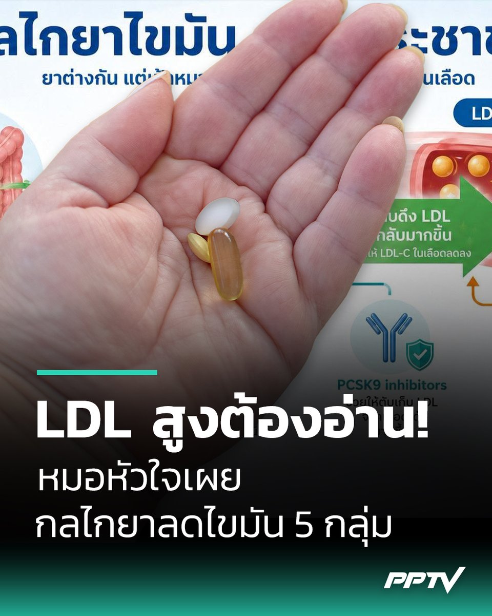 PPTVHD36's tweet photo. หมอหัวใจเผยกลไกยาลดไขมัน ข้อดี และทางเลือกใหม่สำหรับผู้ป่วยไขมันสูง
.
นพ.อกนิษฐ์ ศรีสุขวัฒนา (หมอแอร์) อายุรแพทย์โรคหัวใจ และผู้ชำนาญการด้าน Sports Cardiology โรงพยาบาลสมิติเวช ศรีนครินทร์ เผยผ่านเพจ Akanis Srisukwattana ว่า หลายคนที่มีภาวะไขมันในเลือดสูงได้รับการสั่งจ่ายยาลดไขมัน แต่ยังไม่เข้าใจว่ายาแต่ละชนิดแตกต่างกันอย่างไร บทความนี้จะช่วยให้เข้าใจกลไกการทำงานของยาลดไขมันแต่ละกลุ่ม โดยมีเป้าหมายเดียวกัน คือ ลดระดับ LDL หรือ "ไขมันไม่ดี" ในเลือด เพื่อลดการเกิดคราบไขมันในหลอดเลือด และลดความเสี่ยงโรคหลอดเลือดหัวใจและโรคหลอดเลือดสมอง
.
Statin ยาหลักที่ใช้รักษาไขมันสูง
ยาลดไขมันที่ใช้กันมากที่สุด ออกฤทธิ์โดยลดการสร้างคอเลสเตอรอลที่ตับ เมื่อตับสร้างคอเลสเตอรอลน้อยลง ก็จะดึง LDL จากกระแสเลือดกลับไปกำจัดมากขึ้น นอกจากช่วยลดระดับ LDL แล้ว Statin ยังช่วยลดการอักเสบ และทำให้คราบไขมันในหลอดเลือดหัวใจมีความเสถียรมากขึ้น ลดโอกาสการแตกของคราบไขมัน ซึ่งเป็นสาเหตุสำคัญของภาวะหัวใจวายเฉียบพลัน
ยากลุ่มนี้สามารถลด LDL ได้ประมาณ 30–50% หรือมากกว่า ขึ้นอยู่กับชนิดและขนาดยา โดยมีราคาตั้งแต่หลักหน่วยไปจนถึงประมาณหลักร้อยบาท
.
Ezetimibe ผู้ช่วยของ Statin
หมอแอร์เปรียบเทียบ Ezetimibe ว่าเป็นเหมือน Batman กับ Robin เพราะทำงานเสริมกัน Ezetimibe ออกฤทธิ์คนละตำแหน่งกับ Statin โดยช่วยลดการดูดซึมคอเลสเตอรอลจากลำไส้ ทำให้ไขมันเดินทางกลับเข้าสู่ตับน้อยลง ส่งผลให้ระดับ LDL ลดลงได้ประมาณ 15–20% และในผู้ป่วยบางรายอาจลดได้ถึง 30%
แพทย์มักใช้ร่วมกับ Statin เมื่อการใช้ยาเพียงชนิดเดียวยังลด LDL ไม่ถึงเป้าหมาย ซึ่งในหลายกรณีอาจให้ผลดีกว่าการเพิ่มขนาด Statin จนเกิดผลข้างเคียง ราคายาอยู่ในช่วงหลักสิบบาท ตั้งแต่ประมาณสิบกว่าบาทไปจนถึงหลักสิบกลาง ๆ
.
Bempedoic acid อีกทางเลือกของการรักษา
เป็นยารับประทานที่ช่วยลดการสร้างคอเลสเตอรอลในตับเช่นกัน แต่ทำงานคนละตำแหน่งกับ Statin และถูกกระตุ้นการทำงานเป็นหลักในตับ จึงเหมาะเป็นอีกทางเลือกสำหรับผู้ที่ไม่สามารถใช้ Statin ได้ในขนาดเต็ม หรือใช้ทั้ง Statin และ Ezetimibe แล้วระดับ LDL ยังไม่ลดลงตามเป้าหมาย ยานี้สามารถลด LDL เพิ่มได้ประมาณ 15–25% และหากใช้ร่วมกับ Ezetimibe จะช่วยลด LDL ได้มากขึ้น โดยมีราคาประมาณหลักเกือบร้อยบาท
.
กลุ่มยา PCSK9 ลด LDL ได้อย่างมีประสิทธิภาพ
อีกกลุ่มหนึ่งคือ PCSK9 inhibitor ซึ่งเดิมมีเฉพาะยาฉีด แต่ปัจจุบันมียารับประทานที่ได้รับการอนุมัติจากองค์การอาหารและยาสหรัฐฯ (FDA) แล้ว กลไกของยากลุ่มนี้คือการช่วยรักษา ตัวรับ LDL (LDL receptor) บนผิวเซลล์ตับ ซึ่งทำหน้าที่ดึง LDL ออกจากกระแสเลือด
โดยปกติ โปรตีน PCSK9 จะเข้ามาทำลายตัวรับดังกล่าว ทำให้ตับกำจัด LDL ได้ลดลง ส่งผลให้ไขมันในเลือดสูงขึ้น แต่เมื่อยาสามารถยับยั้ง PCSK9 ได้ ตับจึงมีตัวรับ LDL มากขึ้น และสามารถกำจัด LDL ออกจากเลือดได้อย่างมีประสิทธิภาพ สำหรับยาฉีด ได้แก่ Evolocumab และ Alirocumab ซึ่งสามารถลด LDL ได้ประมาณ 50–60% ส่วน Inclisiranจะออกฤทธิ์ลดการสร้าง PCSK9 ภายในเซลล์ตับ สามารถลด LDL ได้ประมาณ 50% และมีข้อดีคือฉีดเพียงปีละ 2 ครั้ง โดยมีค่าใช้จ่ายประมาณหลักแสนบาทต่อปี
.
PCSK9 ชนิดรับประทานทางเลือกใหม่
หมอแอร์ระบุว่า ล่าสุดมี Enlicitide ซึ่งเป็นยาเม็ดรับประทานวันละครั้ง โดยยาจะถูกดูดซึมผ่านลำไส้ และออกฤทธิ์บริเวณผิวเซลล์ตับ ป้องกันไม่ให้ PCSK9 ทำลายตัวรับ LDL ผลการศึกษาพบว่าสามารถลด LDL ได้ประมาณ 55–60% ใกล้เคียงกับยาฉีด อย่างไรก็ตาม ข้อมูลด้านการป้องกันภาวะหัวใจวายและโรคหลอดเลือดสมองในระยะยาว ยังต้องติดตามเพิ่มเติม คาดว่าราคาจะอยู่ในระดับหลักแสนบาทต่อปี แต่ไม่ถึงครึ่งล้านบาท
.
อนาคตจะมียาสำหรับลด Lipoprotein(a)
หมอแอร์ คาดว่าในอนาคตจะมียาสำหรับลด Lipoprotein(a) หรือ Lp(a) ซึ่งเป็นไขมันชนิดหนึ่งที่เพิ่มความเสี่ยงโรคหัวใจ และพบว่าประชากรราว 20% มีระดับสูงกว่าปกติ แม้ยารุ่นใหม่จะมีราคาค่อนข้างสูงในช่วงแรก แต่เมื่อเวลาผ่านไป ราคามักจะลดลง ทำให้ผู้ป่วยสามารถเข้าถึงการรักษาได้มากขึ้น
.
การควบคุมไขมันต้องทำควบคู่กับการดูแลสุขภาพ
หมอแอร์เน้นย้ำว่า หากสามารถควบคุมระดับไขมันในเลือดได้อย่างเป็นระบบ จะช่วยลดโอกาสเกิดโรคหลอดเลือดหัวใจ ภาวะหัวใจวายเฉียบพลัน และลดการเสียชีวิตก่อนวัยอันควรจากโรคหัวใจได้อย่างมาก ดังนั้น ผู้ที่มีภาวะไขมันในเลือดสูงควรสอบถามแพทย์ตั้งแต่เริ่มรักษาว่า ต้องปฏิบัติตัวอย่างไร และควบคุมค่าต่าง ๆ ให้ถึงเป้าหมาย เช่น ระดับ LDL น้ำตาลในเลือด และความดันโลหิต
.
การดูแลทั้งด้านไลฟ์สไตล์ควบคู่กับการใช้ยาอย่างต่อเนื่อง จะช่วยลดความเสี่ยงการเกิดโรคหลอดเลือดหัวใจเฉียบพลันได้อย่างมีประสิทธิภาพ แม้การเสียชีวิตจะเป็นสิ่งที่หลีกเลี่ยงไม่ได้ แต่การเสียชีวิตฉับพลันจากโรคหลอดเลือดหัวใจนั้น ส่วนใหญ่สามารถป้องกันได้ด้วยการดูแลสุขภาพและการรักษาที่เหมาะสม
.
อ่านต่อ : https://t.co/68mz5yiCHl
.
#ยาลดไขมัน #หมอแอร์ #ไขมันสูง #เรื่องข่าวเรื่องใหญ่ #PPTVHD36