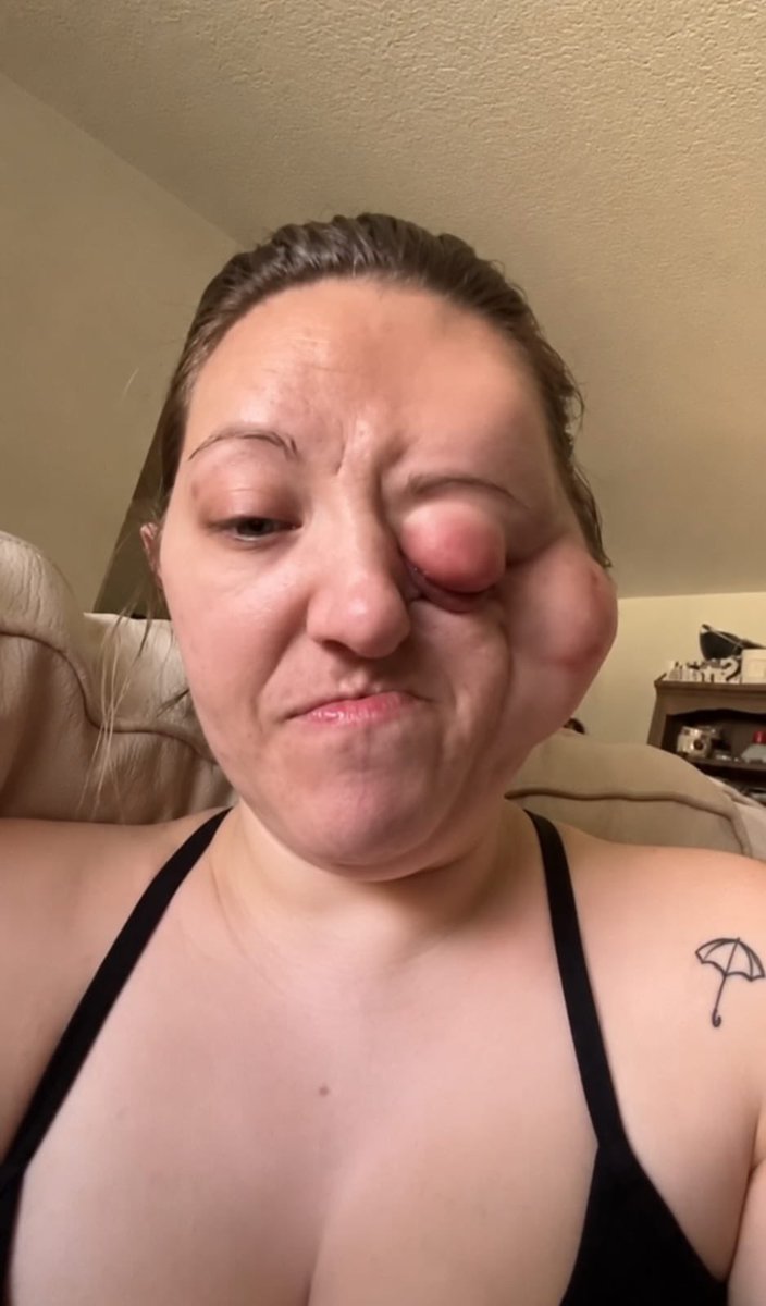 Cassidy0tx9's tweet photo. 💔 Stage 4 cancer has turned my life upside down, but I refuse to lose hope. Every day is a fight to keep going. Please donate or share my fundraiser—your kindness gives me strength and brings me closer to another tomorrow. ❤️🙏 https://t.co/8lCPbQ37ID https://t.co/JM5RLjPGM4