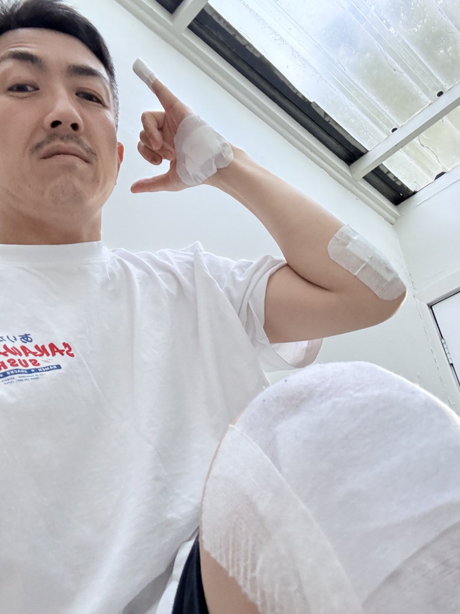 jin_zuru's tweet photo. 気になることがあり、診療所向かったら、予約した診療所の場所を間違え、慌てて向かった診療所の先の階段で転倒し、そのまま治療してもらった45歳をご覧ください🤷‍♂️ https://t.co/qg242EvHJU