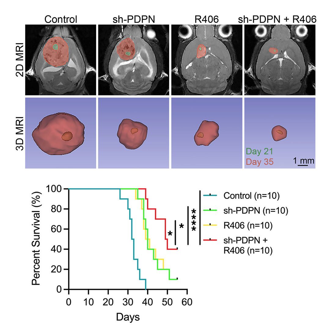 jclinicalinvest's tweet photo. @Jason_Li1026 @DanielJBrat @NUFeinbergMed Combination treatment resulted in the greatest suppression of tumor growth, with smaller tumor volumes compared with single-intervention groups. https://t.co/wCbZoXNven