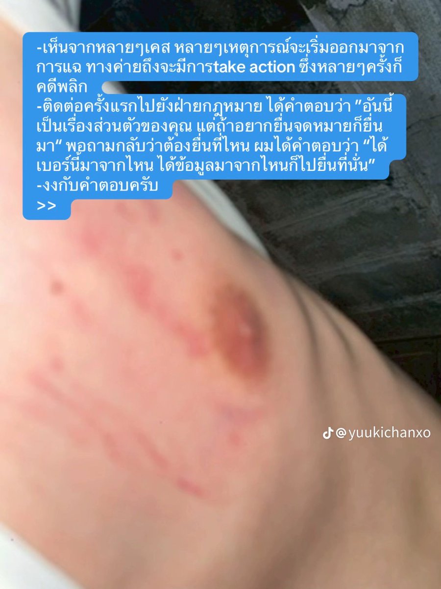 WaaaOhhh's tweet photo. ก่อนหน้านี้เดาไม่ได้ ตอนนี้ก็เดาไม่ออก ล่าสุดเขาออกมาอัปเดตล่ะ ว่าเรื่องถึงไหน 
🥹🥹 มีเฉลยไหม จะได้เลิกติดตาม

#ศิลปินค่ายดังทำร้ายร่างกาย https://t.co/r48XUdUr8i