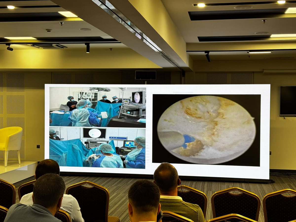 quanta_system's tweet photo. Highlights from the #LiveSurgery at #BeEndo26 in Armenia🇦🇲
A live Laser Enucleation of the Prostate (HoLEP) performed by Dr. Michael Baboudjian using #CyberHoMagneto🧲, alongside our official distributor, @Lusonics_
#QuantaSystem #BeQuanta #UrologyInnovation https://t.co/lGgRfTVkP7