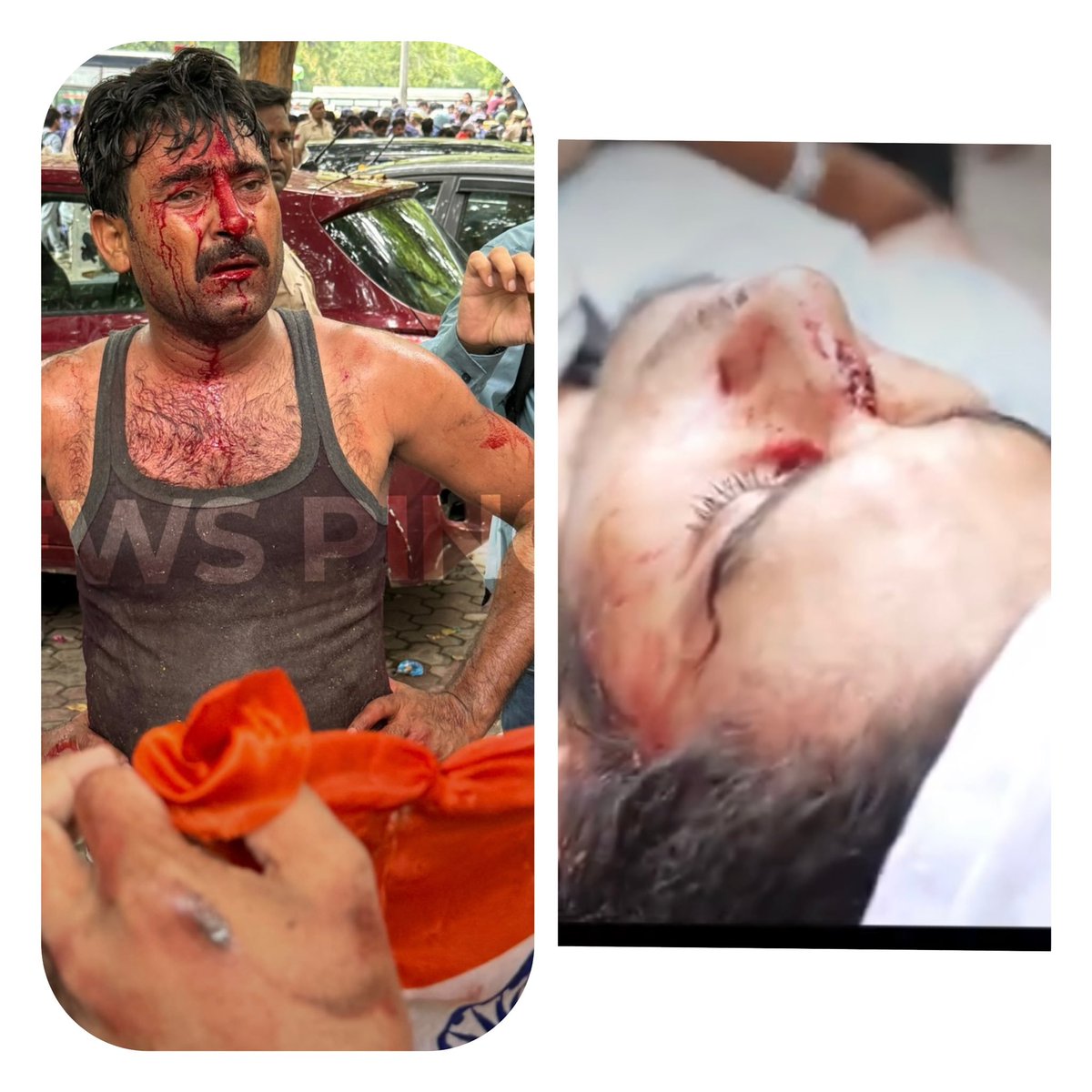 SamWithAI's tweet photo. The Scene is very terrifying 😞

#StudentProtest #YouthPower #Democracy #RightToProtest #HumanRights #FreedomOfSpeech #India #IndianPolitics #BreakingNews #NewsUpdate #StandWithStudents #Justice #JantarMantar #PoliticalNews #Trending #Protest #PublicVoice #Constitution #ViralNews #CJP #CockroachJantaParty