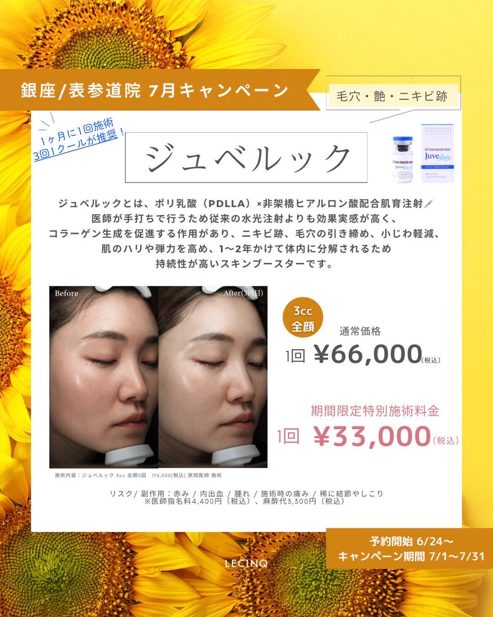 LecinqG's tweet photo. ジュベルックのキャンペーンです。
ジュベルックによって肌のはり、ツヤ、毛穴改善が期待できます。
内出血が起こりますので3日ほど予定がない時をおすすめします。
痛みが苦手な方にはブロック麻酔の併用も可能です。
よろしくお願いいたします。 https://t.co/kv1FfmjQFL