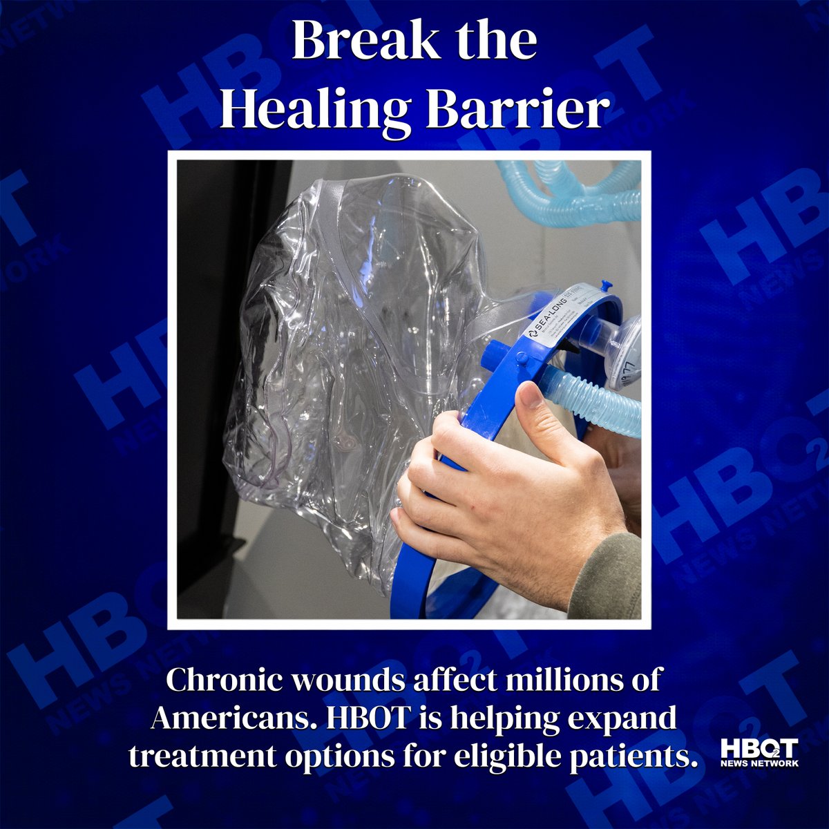 NewsHbot's tweet photo. A new HBOT program is helping patients with chronic wounds access advanced healing therapies without leaving their community.

Learn More: https://t.co/oGHBYJ56Zk https://t.co/5LOLrfcTKQ