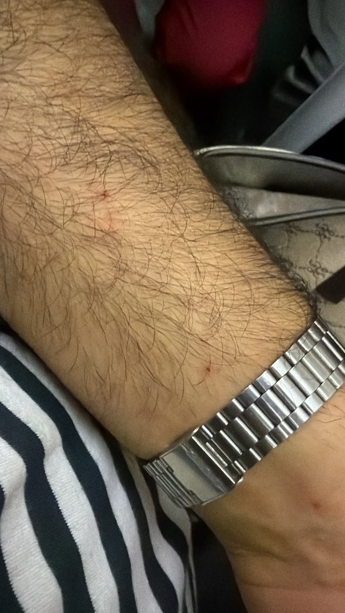 zambakinsani_'s tweet photo. Az önce Beyoğlu'nda kendisiyle karşılaştık ve kedomun yanına götürdüm bilerek dayak yesin diye. 1 erkek daha yaralanmıştır. 
@diptenderin https://t.co/QEsAD5nScV