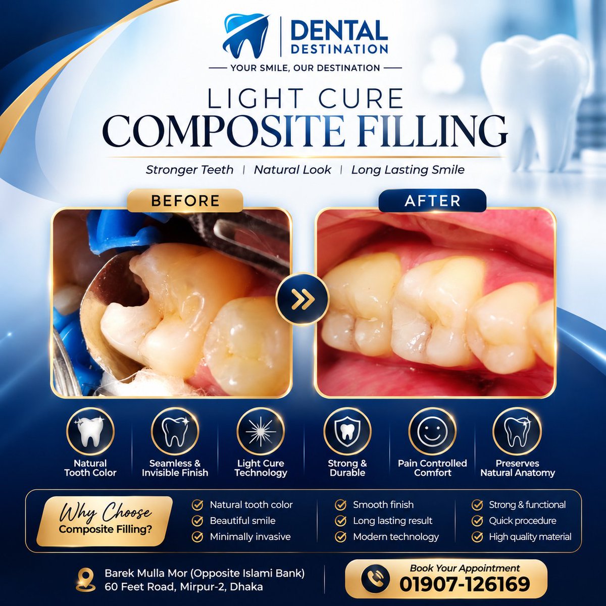 dentistbangla's tweet photo. 🦷 Restore your smile with Light Cure Composite Filling at Dental Destination, Mirpur-2. 
Natural-looking, durable, and tooth-colored restorations for broken or decayed teeth. 

#CompositeFilling #CosmeticDentistry #DentalCare #Dentist #Mirpur2 #BangladeshDentist https://t.co/tW20fAEtnf