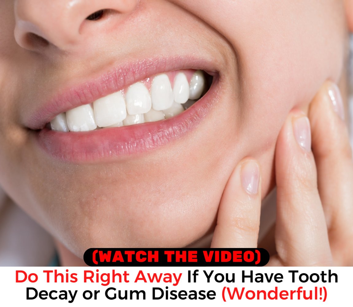 WinJose8's tweet photo. #dental #dentalcare #teethgoals #prodentimprobiotic
#teeth #smiles #prodentim #whiteteeth #healthcare  
#OralCare #tooth #decay #viral #DentalHealth
Restore your dental health with this powerful 
oral care product. 👇Click to learn more
👉 https://t.co/1oGbpQfhcw 👈 https://t.co/g9jEJYQSf4
