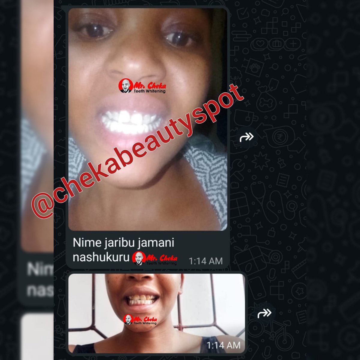 chekabeautyspot's tweet photo. feedback kutoka kwa mteja wetu aliyetumia Dawa ya Mr cheka instant whitening solution Kusafisha Meno yake... karibu cheka beauty spot kwani ndio tabasamu linapopatikana https://t.co/WcVKDnzL7B