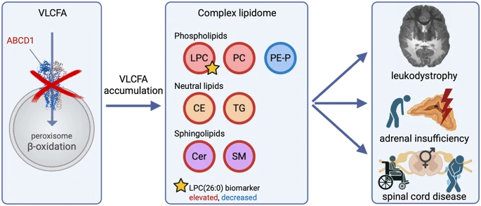MolNeuro's tweet photo. The complex #lipidome as a driver of tissue-specific pathology in #adrenoleukodystrophy

Stephan Kemp, Marc Engelen, Yorrick R. J. Jaspers @amsterdamumc #lipidomics #leukodystrophy #neuroinflammation

https://t.co/PYU2CRqEoS https://t.co/o2fb4J7eC8