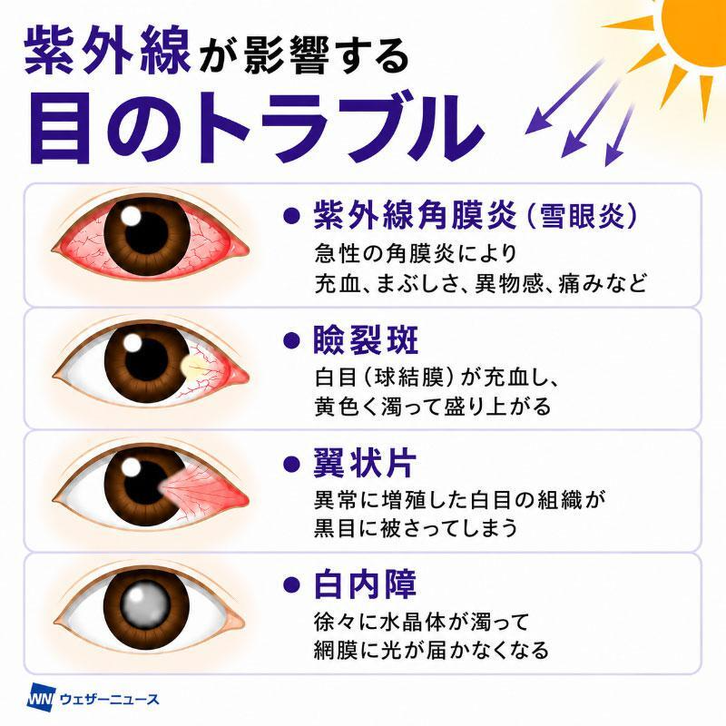 wni_jp's tweet photo. 【目の紫外線対策👀】
各地で梅雨明けが発表され、夏本番の強い日差しが照りつける季節がやってきました。
UVカットが不十分なサングラスでは、かえって目に届く紫外線量が増えてしまうことも。
サングラスの選び方から"目の日焼け"の応急処置まで、詳しく解説します。
https://t.co/RilUXX5zJJ https://t.co/GzlieWTgdw