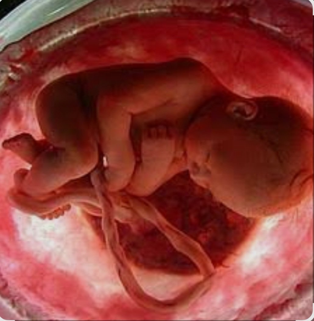Jhoncrack_4's tweet photo. Un bebé en el útero "no es un bebé" pero un hombre con vestido "es una mujer".

¿Por qué no os váis a tomar por culo de una puta vez progres? https://t.co/yCoG5smc3L