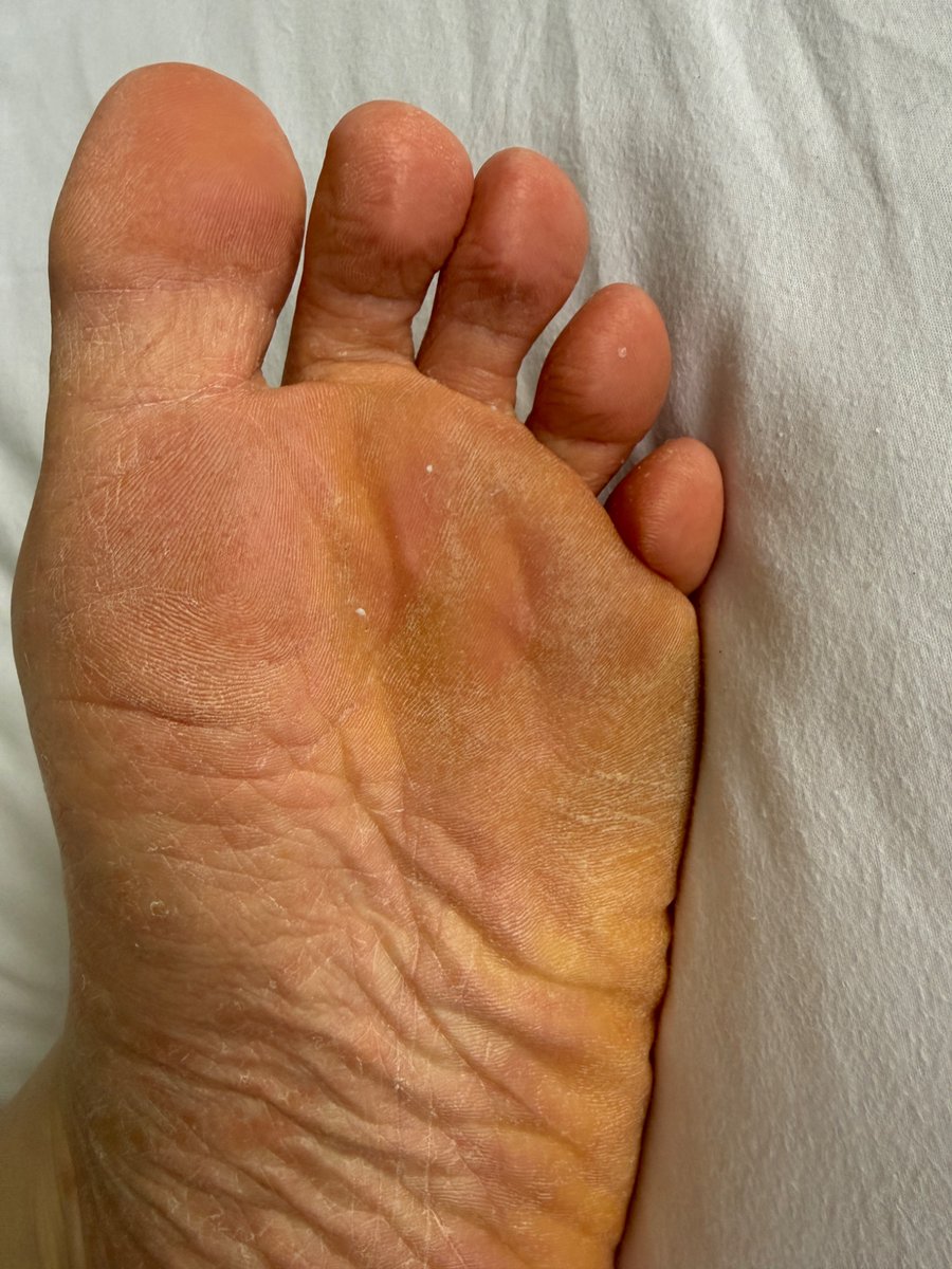 Real_NoFilter's tweet photo. Get your nose right in my toes and inhale that rank foot stink!

#footstink #socks #malefeet #sniff https://t.co/aziA6h7nKq