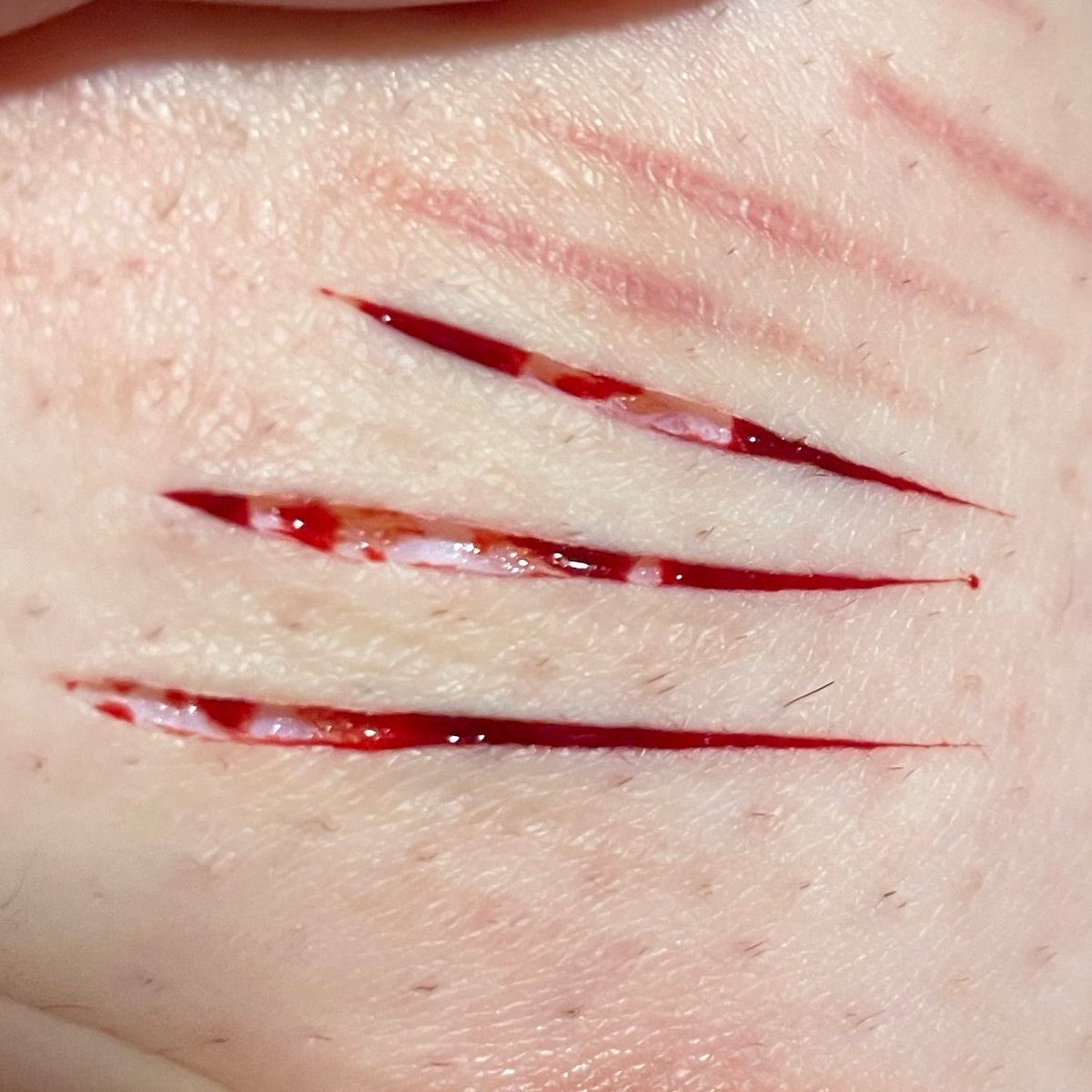 Owwwwchie's tweet photo. Deep styro+ Baby beans 
#shtwt #shedtwt #sledtwt #slittwt #988shtwt #988twt #beanstwt #styrotwt 

FAKE SFX MAKEUP MY ACCOUNT IS PARODY https://t.co/jGHmJtU9mg
