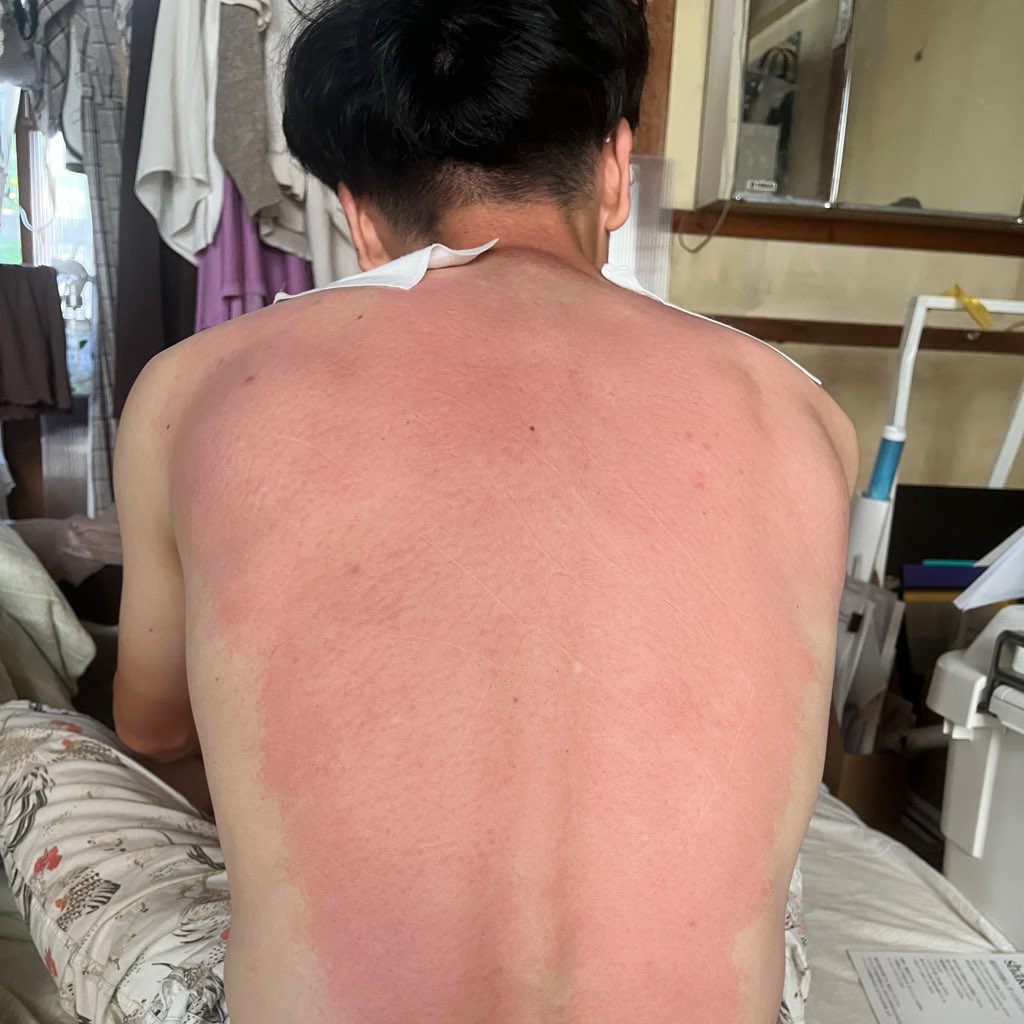 re_aqu's tweet photo. エアコンのない部屋で寝てるので朝起きてすでに体力6割みたいな状態を改善すべく、シャクティマットを購入
思ってたよりかなりトゲトゲ🦔
背中は誇張なしでむっちゃ痛い
首は寝れちゃう感じで心地よい
これは買ってよかった！ https://t.co/rZAspdrGti