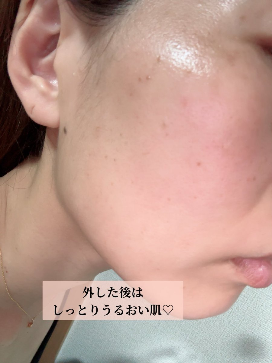 riayama's tweet photo. モニターステーションのモニターキャンペーンで、NMNモイストリペア バイオセルロースマスクをお試しさせていただきました✍️ 小鼻やフェイスラインまでしっかりフィット！浮きにくくズレにくいので、ながらケアにも🙆‍♀️ #モニターステーション #PR  #ナチュレリカバー #ギフトにおすすめ #フェイスマスク https://t.co/Agrg6WRzWR
