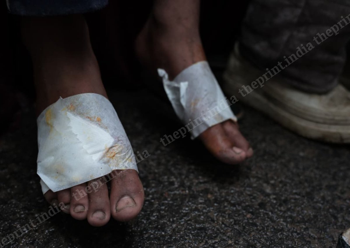 ThePrintIndia's tweet photo. Cockroach Janta Party founder Abhijeet Dipke meets students who were injured during the 20 July protest march.

Photos: Suraj Singh Bisht @Surajbisht25 

#ThePrintPictures https://t.co/MAsaXnsrdb