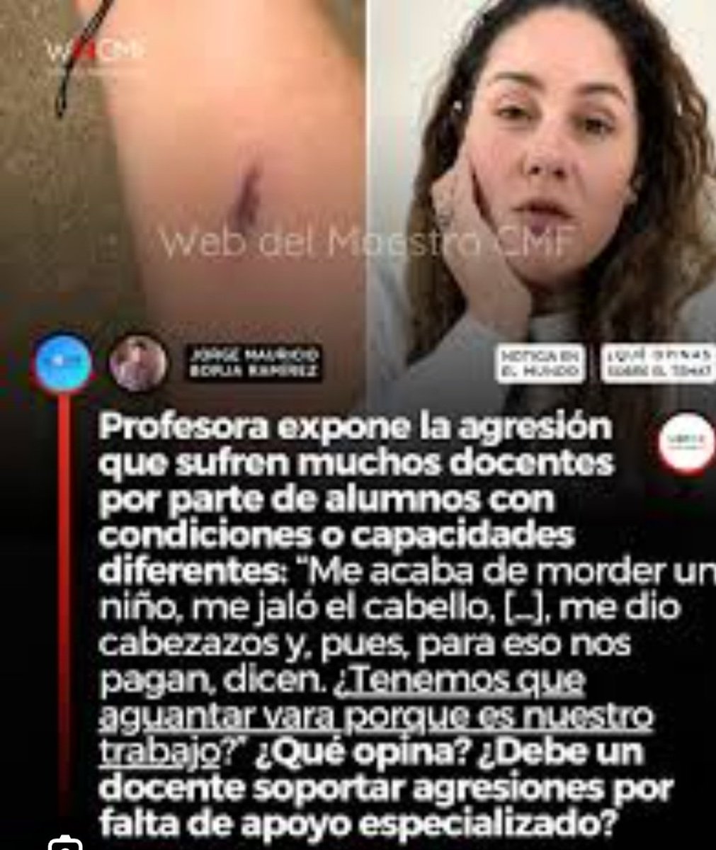 JulietaSagnay's tweet photo. La inclusión educativa no puede reducirse solo a decirle a una familia: "Contrate un maestro sombra" sería transferir al hogar la responsabilidad de un sistema que no ha evolucionado, nisiquiera con un diagnóstico.  

La verdadera inclusión consiste en formar docentes, adaptar la malla curricular, generar estrategias pedagógicas basadas en evidencia y crear escuelas capaces de enseñar a estudiantes con diferentes formas de aprender. El objetivo no es que el niño se adapte a un sistema rígido, sino que el sistema tenga la capacidad de responder a la diversidad.

Hay niños que requieren apoyos individuales y un maestro sombra puede ser una herramienta valiosa cuando existe una indicación clínica y educativa bien fundamentada. Sin embargo, convertir este recurso en la respuesta automática para cualquier dificultad escolar refleja una profunda falta de comprensión sobre los trastornos del neurodesarrollo.

No todo niño inquieto tiene TDAH. No todo niño con dificultades sociales tiene TEA. No todo bajo rendimiento académico significa discapacidad intelectual. Lamentablemente, el incremento de diagnósticos apresurados ha ido de la mano con la aparición de pseudo profesionales y centros que lucran con el miedo de los padres, ofreciendo etiquetas diagnósticas y tratamientos sin suficiente sustento científico.

Es importante recordar que el diagnóstico de un trastorno del neurodesarrollo es MEDICO Debe ser realizado por un paidopsiquiatra (psiquiatra infantil) o un neuropediatra, médicos con formación especializada, quienes posteriormente derivan al niño para una evaluación e intervención interdisciplinaria con psicólogos infantiles, psicopedagogos, terapeutas ocupacionales y otros profesionales según cada caso. La evaluación no depende únicamente de pruebas psicométricas; estas son herramientas complementarias. 
El diagnóstico se fundamenta en una valoración clínica integral, la historia del desarrollo, la observación del funcionamiento del niño y los criterios diagnósticos establecidos.

Necesitamos preparar profesionales competentes, brindar psicoeducación a las familias, capacitar a los docentes, fortalecer los departamentos de psicología y desarrollar políticas públicas que hagan de la inclusión una realidad .

La inclusión no beneficia a todos los niños de la misma manera. Cada caso debe evaluarse de forma individual. Cuando un estudiante es incorporado a un entorno sin apoyos adecuados, sin docentes capacitados y expuesto al rechazo, la exclusión social o el bullying, este acto de inclusión puede convertirse en una experiencia profundamente dañina. 

En esos casos, el remedio termina siendo peor que la enfermedad.

La inclusión sin ciencia, evidencia,  formación y sin recursos,  deja de ser un derecho y se convierte en una ilusión que solo pagan los niños y sus familias.