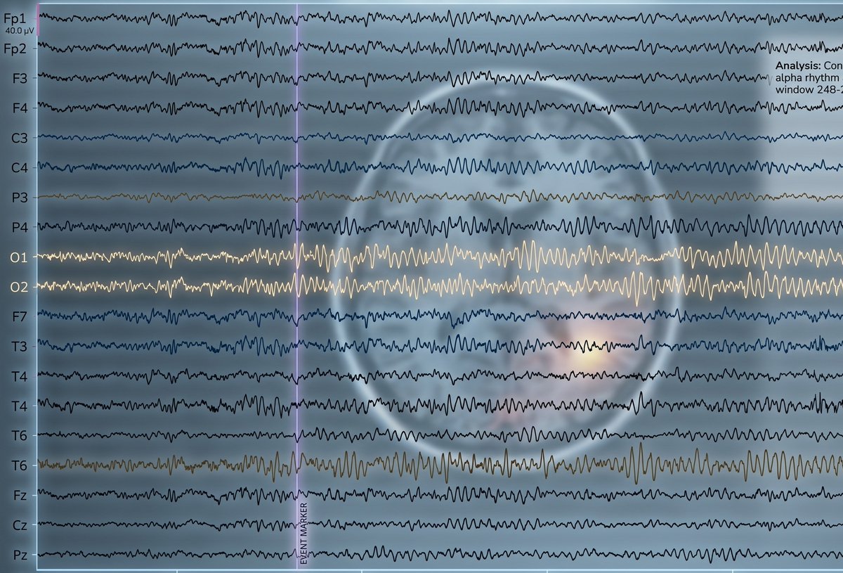 PAN_akademia's tweet photo. Czy z zapisu EEG można rozpoznać rodzaj przyjmowanego leku?

Naukowcy z @NenckiInstitute PAN przeanalizowali ponad 24 tys. badań EEG i pokazali, jak 14 grup leków psychiatrycznych wpływa na aktywność mózgu. Wyniki opublikowano w @eBioMedicine (@TheLancet ). 🧠

🔗Więcej na stronie: https://t.co/BANAjdgbLM