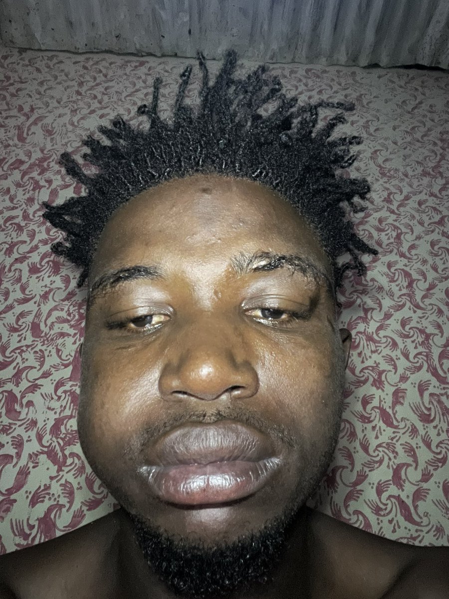 delco915529's tweet photo. Hello My Brothers in faith how are you all doing today? Please I need help to go to the hospital. I deeply need of help for the love of humanity and for the shake of God. I am definitely going through a lot https://t.co/WbsYgVgqXL