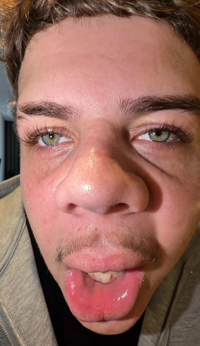 CallumsOnX tweet picture