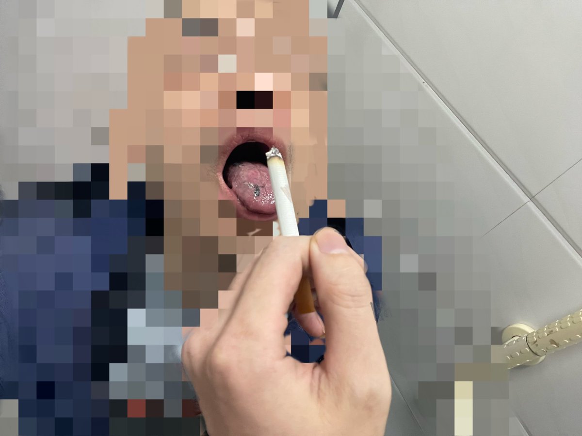 secrecturinal's tweet photo. 請男爹吸煙換取做煙灰缸的機會，結果最後被一個假動作三口痰寸爆🫠，事後被男爹嘲笑：傻逼只會吃痰流膿👍 https://t.co/83dsjSuCr7