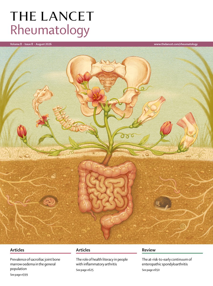 TheLancetRheum's tweet photo. Our August 2026 issue is live!

Including research on sacroiliac joint #bonemarrowoedema, a precision medicine tool in #Sjögrens disease, the role of #healthliteracy in #inflammatoryarthritis, plus much more! https://t.co/P59OyDJIw5

Cover by @emmacreats https://t.co/l7IFQ7ixSl