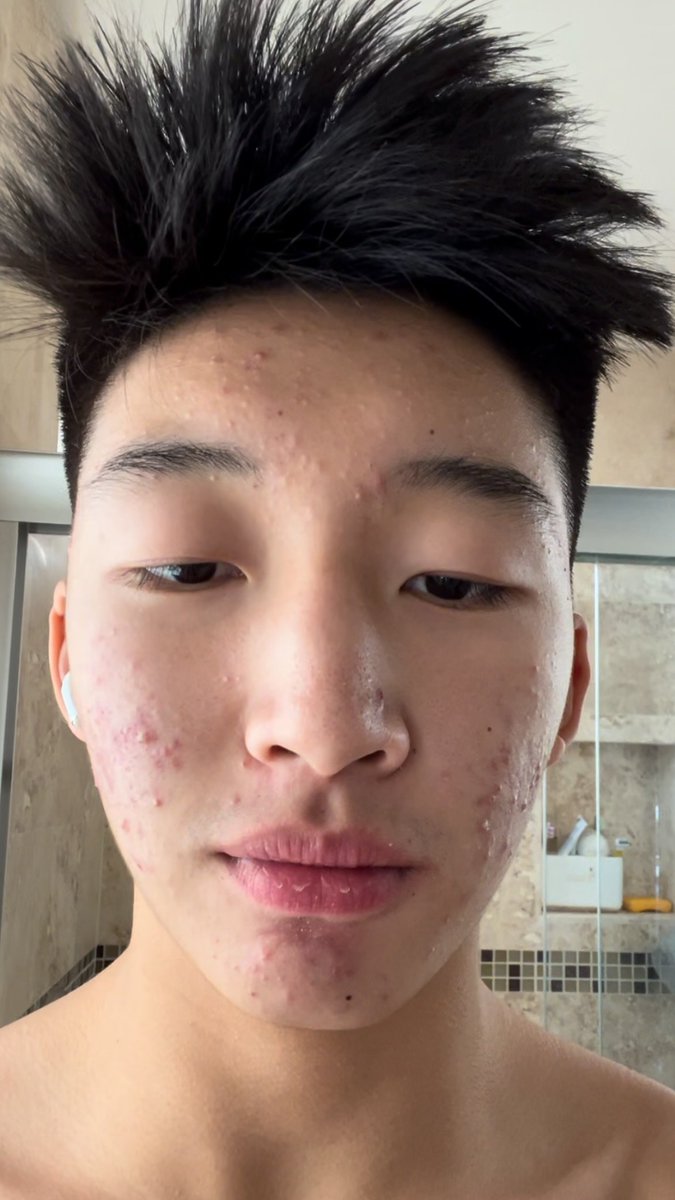 jstnnch's tweet photo. 🔥🔥 https://t.co/ix7TQJ0aAV