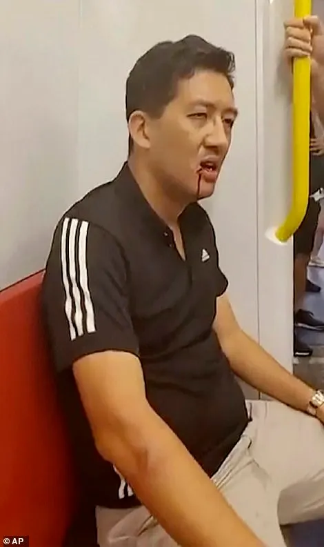 hkdc_us's tweet photo. HK pro-democracy leader Lam Cheuk-ting rushed to Yuen Long on 721 to try to protect citizens from the attacks. For his efforts, he was beaten, arrested, absurdly convicted of "riot" &amp; sentenced to 37mo in prison. https://t.co/ghBgamrhM0 https://t.co/SFIioE7byT