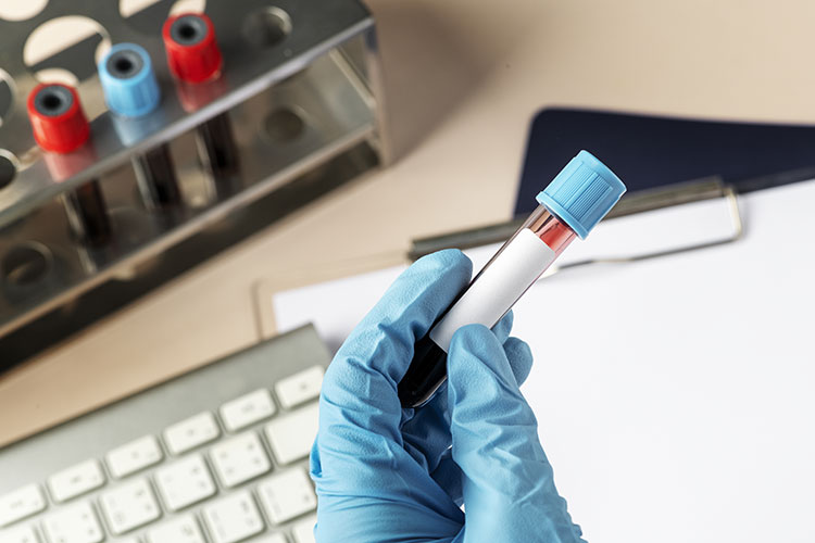 Lab_Network's tweet photo. Exames laboratoriais permitem identificar hepatites antes de sintomas
Com + de 826 mil casos no Brasil entre 2000 e 2024, especialista alerta q ausência de sintomas nas fases iniciais faz do diagnóstico precoce o principal aliado para evitar complicações https://t.co/6w8VmMbgrM https://t.co/H7gs1D91mM