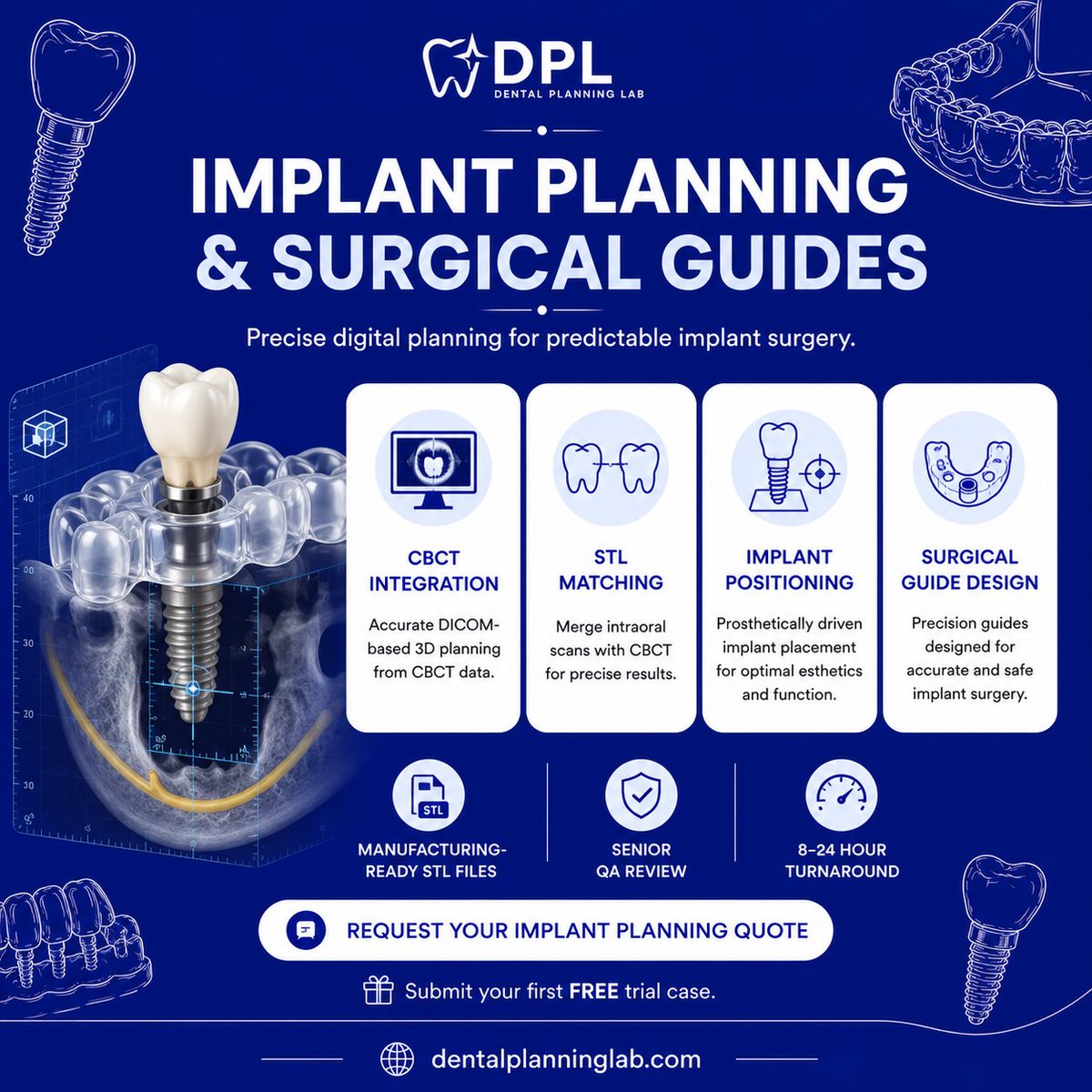DentalPlanLab's tweet photo. 🦷 Better implant outcomes begin with better planning.

Our Implant Planning service includes:

✅ CBCT Integration
✅ STL Matching
✅ Implant Positioning
✅ Surgical Guide Design

🎁Submit your first FREE trial case.
🌐https://t.co/84jxqsl2gS
#ImplantPlanning #DigitalDentistry https://t.co/tlbMd2BKjf