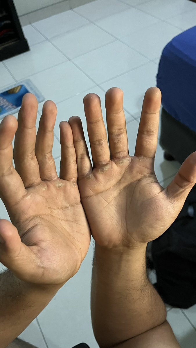 nodeexpressjs's tweet photo. Tbak cara foto tangan nya (sekalian post progress aje) https://t.co/7os1RLo7UY