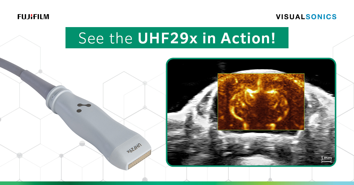 VisualSonics's tweet photo. Discover the UHF29x transducer for Vevo F2xc! Ultra-high frequency ultrasound with exceptional resolution for detailed preclinical imaging. 

Learn more: https://t.co/ZRFlbt70wa 

#highfrequency #ultrasound #VevoImaging #PreclinicalResearch https://t.co/LittlOQqlX
