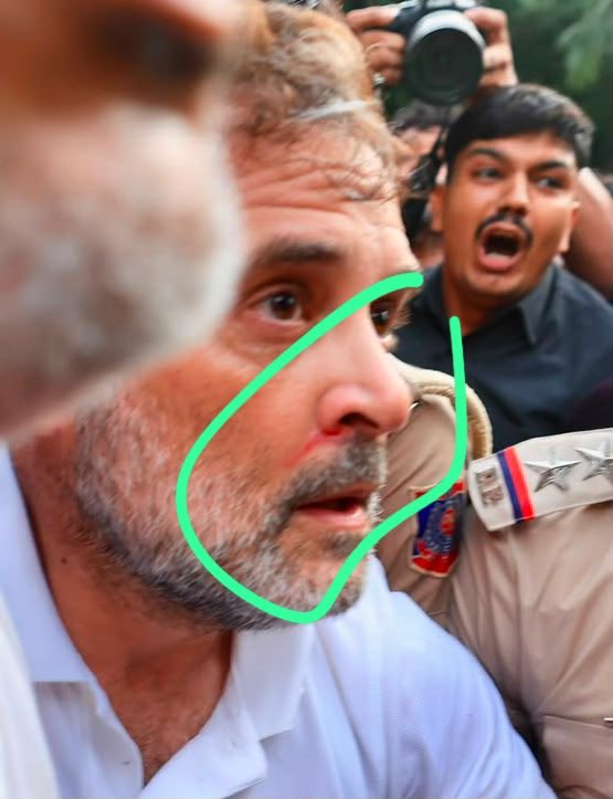 SilentEyes0106's tweet photo. दिल्ली पोलिसांची ही क्रूरता पाहा!

हे राहुल गांधी आहेत…देशाचे विरोधी पक्षनेते. त्यांना धक्काबुक्की करून मारहाण करण्यात आली आणि ते जखमी आहेत…

दिल्ली पोलिसांनी एक गोष्ट लक्षात ठेवावी, ते राहुल गांधी आहेत! 
दडपशाहीने त्यांचा आवाज दाबता येणार नाही…

दिल्ली पोलीस अमित शाह यांच्या अखत्यारीत आहेत…आणि हे देश पाहतोय!