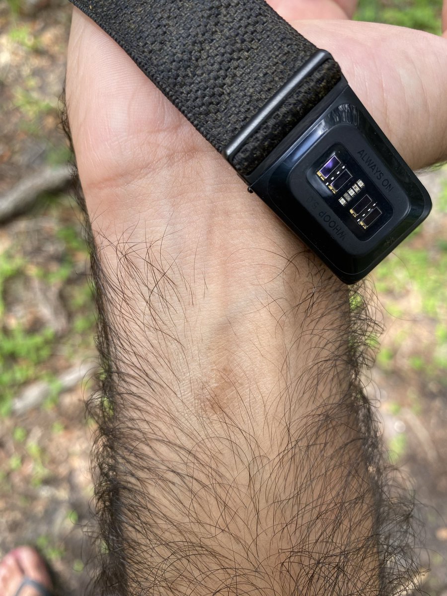 GooberStudios's tweet photo. Took my @WHOOP off after wearing it for 1 year and noticed a patch of damaged skin where the sensor hits the skin.

The rest of my wrist where the strap goes is fine

But the part where the sensor goes its chapped, dry and damaged

Has this happened to anyone else? https://t.co/IYX4KxnoqO